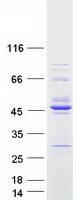 RCCD1 Protein - Purified recombinant protein RCCD1 was analyzed by SDS-PAGE gel and Coomassie Blue Staining