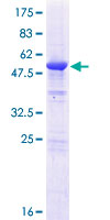 RCD1 / RQCD1 Protein - 12.5% SDS-PAGE of human RQCD1 stained with Coomassie Blue