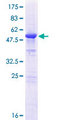 RCD1 / RQCD1 Protein - 12.5% SDS-PAGE of human RQCD1 stained with Coomassie Blue