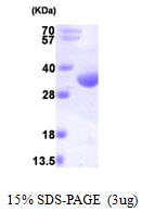 RCD1 / RQCD1 Protein