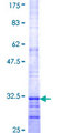 RCE1 Protein - 12.5% SDS-PAGE Stained with Coomassie Blue.