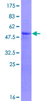 RCHY1 / PIRH2 Protein - 12.5% SDS-PAGE of human RCHY1 stained with Coomassie Blue