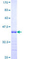 RCHY1 / PIRH2 Protein - 12.5% SDS-PAGE Stained with Coomassie Blue.