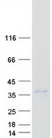 RCHY1 / PIRH2 Protein - Purified recombinant protein RCHY1 was analyzed by SDS-PAGE gel and Coomassie Blue Staining