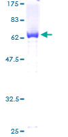 RCN1 / Reticulocalbin 1 Protein - 12.5% SDS-PAGE of human RCN1 stained with Coomassie Blue