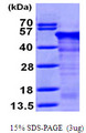 RCN1 / Reticulocalbin 1 Protein