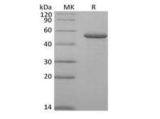 RCN2 Protein - Recombinant Human RCN2 (C-6His)