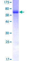 RCN2 Protein - 12.5% SDS-PAGE of human RCN2 stained with Coomassie Blue