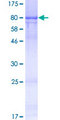RCOR1 / COREST Protein - 12.5% SDS-PAGE of human RCOR1 stained with Coomassie Blue