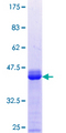 RCSD1 Protein - 12.5% SDS-PAGE Stained with Coomassie Blue.