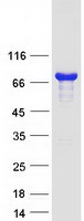 RCSD1 Protein - Purified recombinant protein RCSD1 was analyzed by SDS-PAGE gel and Coomassie Blue Staining