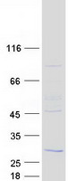 RD3 Protein - Purified recombinant protein RD3 was analyzed by SDS-PAGE gel and Coomassie Blue Staining