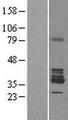 RDH1 / RDH5 Protein - Western validation with an anti-DDK antibody * L: Control HEK293 lysate R: Over-expression lysate