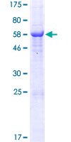 RDH10 Protein - 12.5% SDS-PAGE of human RDH10 stained with Coomassie Blue