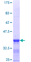 RDH10 Protein - 12.5% SDS-PAGE Stained with Coomassie Blue.