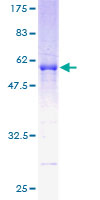 RDH11 Protein - 12.5% SDS-PAGE of human RDH11 stained with Coomassie Blue