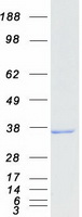 RDH11 Protein - Purified recombinant protein RDH11 was analyzed by SDS-PAGE gel and Coomassie Blue Staining