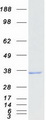 RDH11 Protein - Purified recombinant protein RDH11 was analyzed by SDS-PAGE gel and Coomassie Blue Staining
