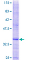 RDH12 / LCA3 Protein - 12.5% SDS-PAGE Stained with Coomassie Blue.