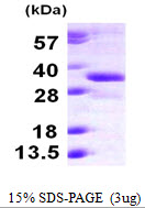 RDH12 / LCA3 Protein