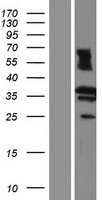 RDH13 Protein - Western validation with an anti-DDK antibody * L: Control HEK293 lysate R: Over-expression lysate