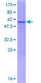 RDH13 Protein - 12.5% SDS-PAGE of human RDH13 stained with Coomassie Blue