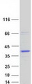 RDH13 Protein - Purified recombinant protein RDH13 was analyzed by SDS-PAGE gel and Coomassie Blue Staining