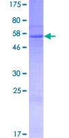 RDH8 Protein - 12.5% SDS-PAGE of human RDH8 stained with Coomassie Blue