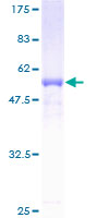 RDHE2 / SDR16C5 Protein - 12.5% SDS-PAGE of human RDHE2 stained with Coomassie Blue