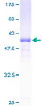 RDHE2 / SDR16C5 Protein - 12.5% SDS-PAGE of human RDHE2 stained with Coomassie Blue