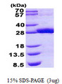 RDHE2 / SDR16C5 Protein