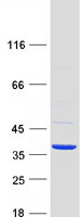 RDHE2 / SDR16C5 Protein - Purified recombinant protein SDR16C5 was analyzed by SDS-PAGE gel and Coomassie Blue Staining