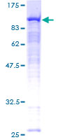 RDX / Radixin Protein - 12.5% SDS-PAGE of human RDX stained with Coomassie Blue