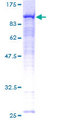 RDX / Radixin Protein - 12.5% SDS-PAGE of human RDX stained with Coomassie Blue