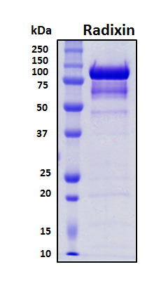 RDX / Radixin Protein - SDS-PAGE under reducing conditions and visualized by Coomassie blue staining