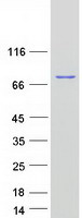 RDX / Radixin Protein - Purified recombinant protein RDX was analyzed by SDS-PAGE gel and Coomassie Blue Staining