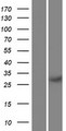 REC114 / C15orf60 Protein - Western validation with an anti-DDK antibody * L: Control HEK293 lysate R: Over-expression lysate