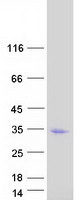 REC114 / C15orf60 Protein - Purified recombinant protein REC114 was analyzed by SDS-PAGE gel and Coomassie Blue Staining