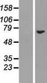 REC8 Protein - Western validation with an anti-DDK antibody * L: Control HEK293 lysate R: Over-expression lysate
