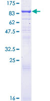 REC8 Protein - 12.5% SDS-PAGE of human REC8 stained with Coomassie Blue