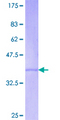 REC8 Protein - 12.5% SDS-PAGE Stained with Coomassie Blue.
