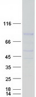 REC8 Protein - Purified recombinant protein REC8 was analyzed by SDS-PAGE gel and Coomassie Blue Staining