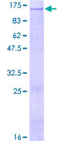 RECK Protein - 12.5% SDS-PAGE of human RECK stained with Coomassie Blue