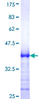 RECK Protein - 12.5% SDS-PAGE Stained with Coomassie Blue.