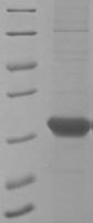 Recoverin Protein - (Tris-Glycine gel) Discontinuous SDS-PAGE (reduced) with 5% enrichment gel and 15% separation gel.