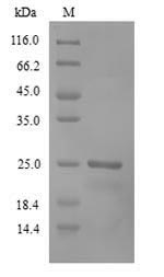 Recoverin Protein - (Tris-Glycine gel) Discontinuous SDS-PAGE (reduced) with 5% enrichment gel and 15% separation gel.