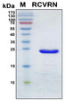 Recoverin Protein - SDS-PAGE under reducing conditions and visualized by Coomassie blue staining