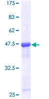 Recoverin Protein - 12.5% SDS-PAGE of human RCV1 stained with Coomassie Blue