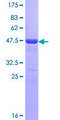 Recoverin Protein - 12.5% SDS-PAGE of human RCV1 stained with Coomassie Blue