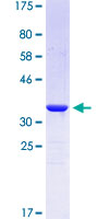 Recoverin Protein - 12.5% SDS-PAGE Stained with Coomassie Blue.
